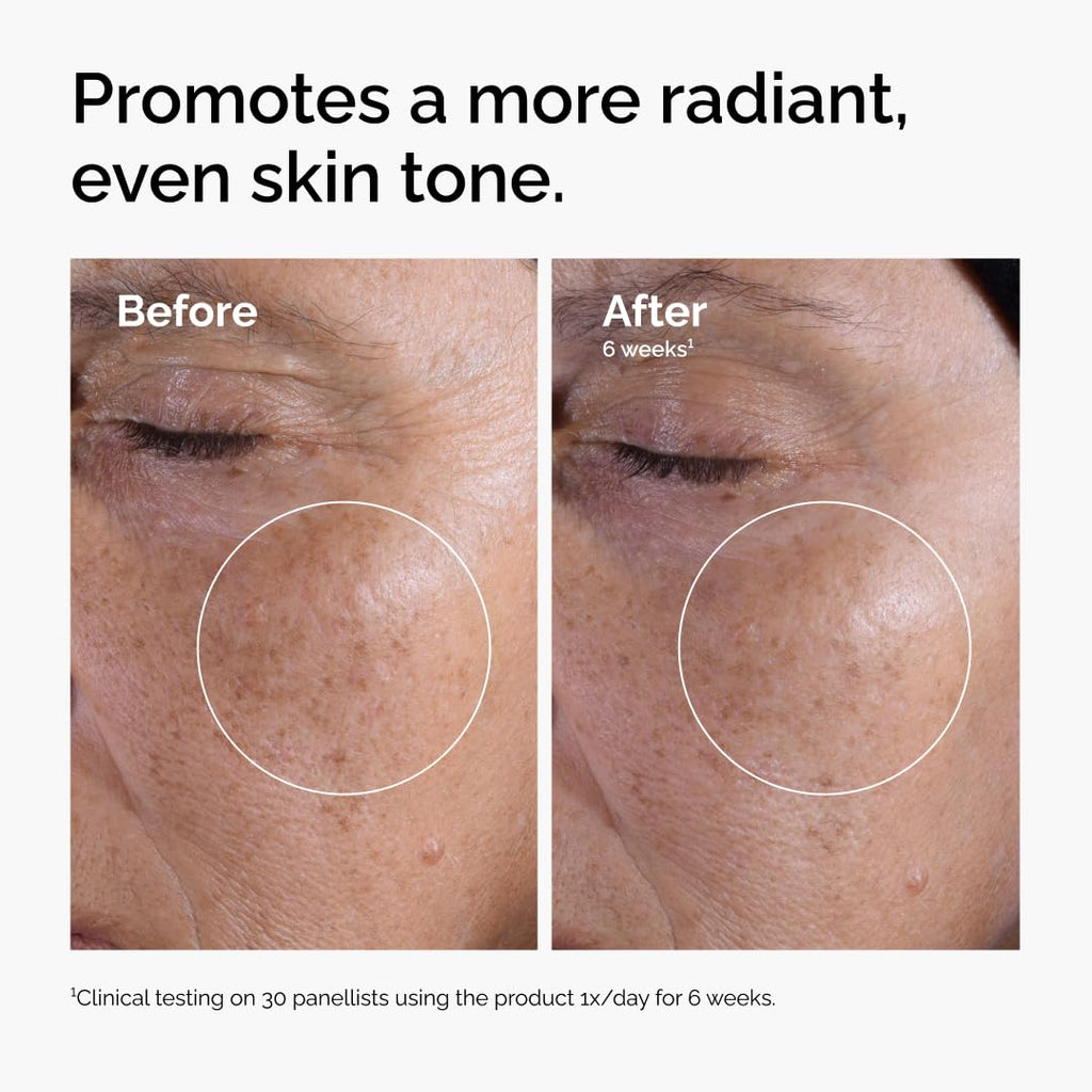 The Ordinary Glycolic Acid 7% Exfoliating Toner, Brightening and Smoothing Daily Toner for More Even-Looking Skin Tone